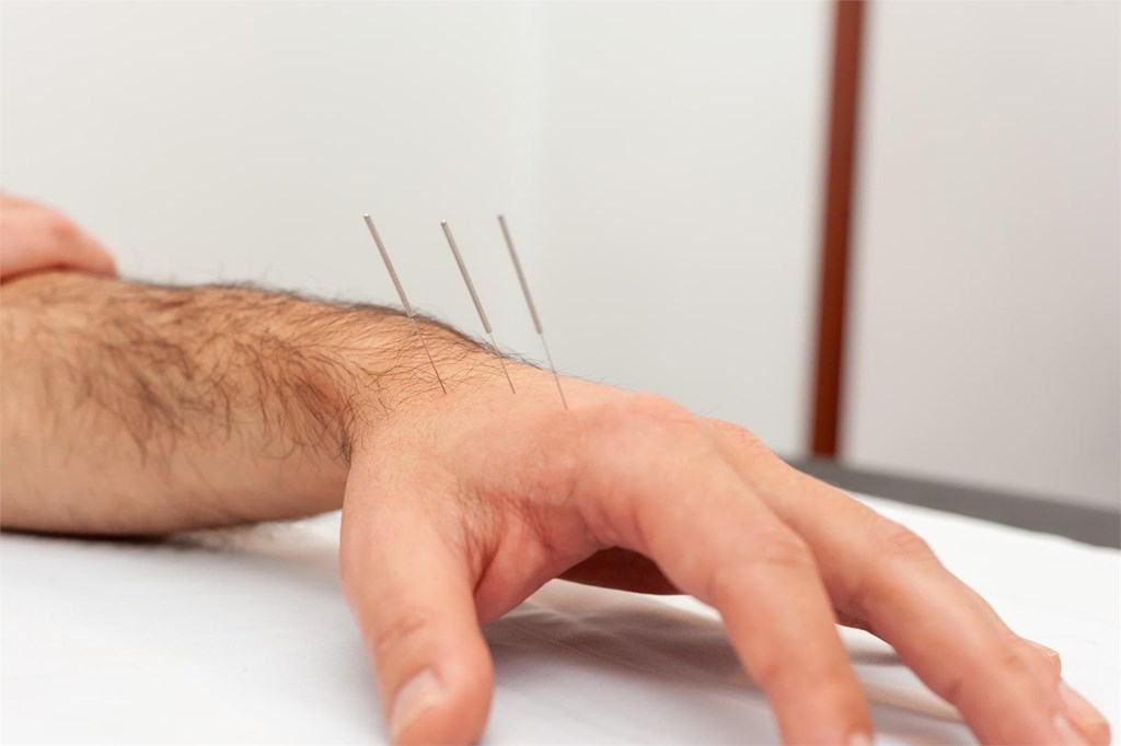 KINESALUD Kinesiología, Fisiatría y Acupuntura en José C. Paz - BARRIO SANTA PAULA - Acupuncture