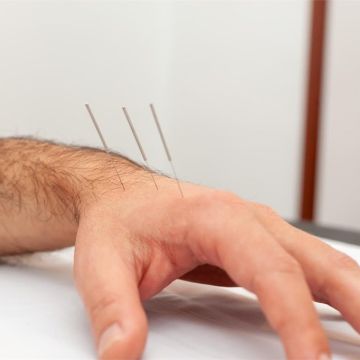 KINESALUD Kinesiología, Fisiatría y Acupuntura en José C. Paz - BARRIO SANTA PAULA - Acupuncture