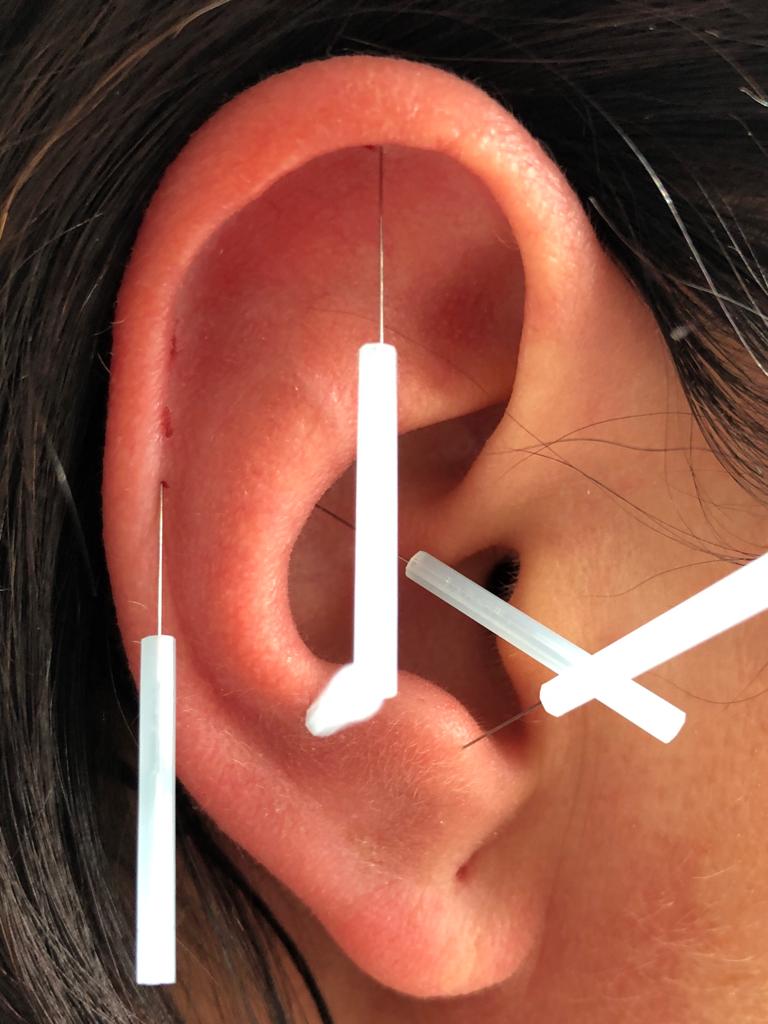 Naturheilkunde Bioresonanz - Bioresonanztherapie - Blutegeltherapie Potsdam - Drip Spa - Hypnose Potsdam - Potsdam - Masaje medicinal