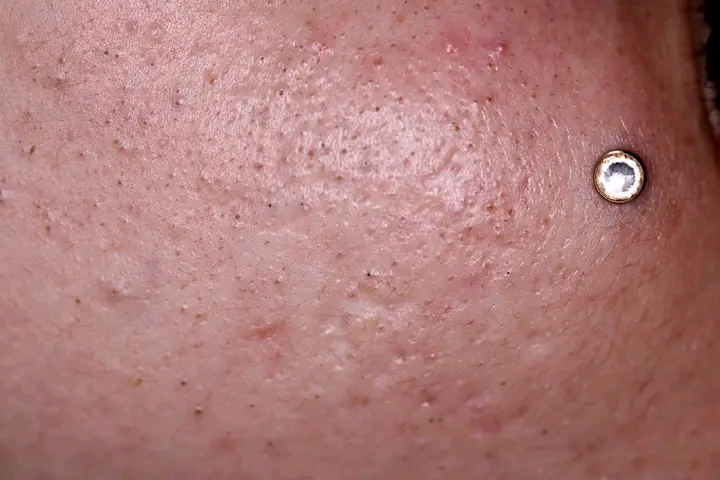 Academia de estetica cosmi laura - Santo Domingo de Guzmán - Skin Cleansing