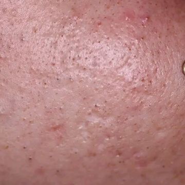 Academia de estetica cosmi laura - Santo Domingo de Guzmán - Skin Cleansing