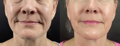 I work off commission at ZenVida Wellness & Aesthetics - Samaná - Beauty services