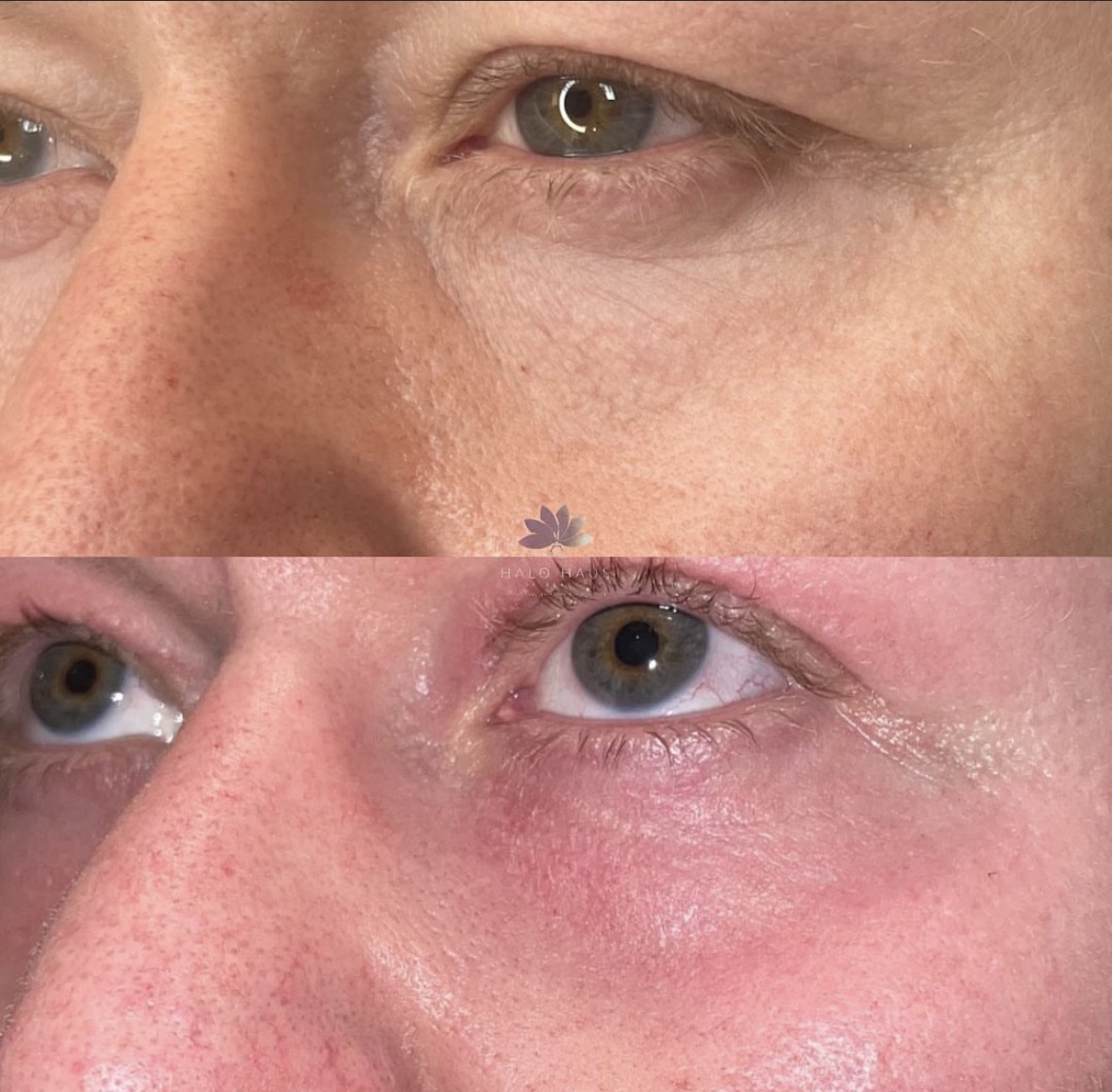 I work off commission at ZenVida Wellness & Aesthetics - Samaná - Beauty services