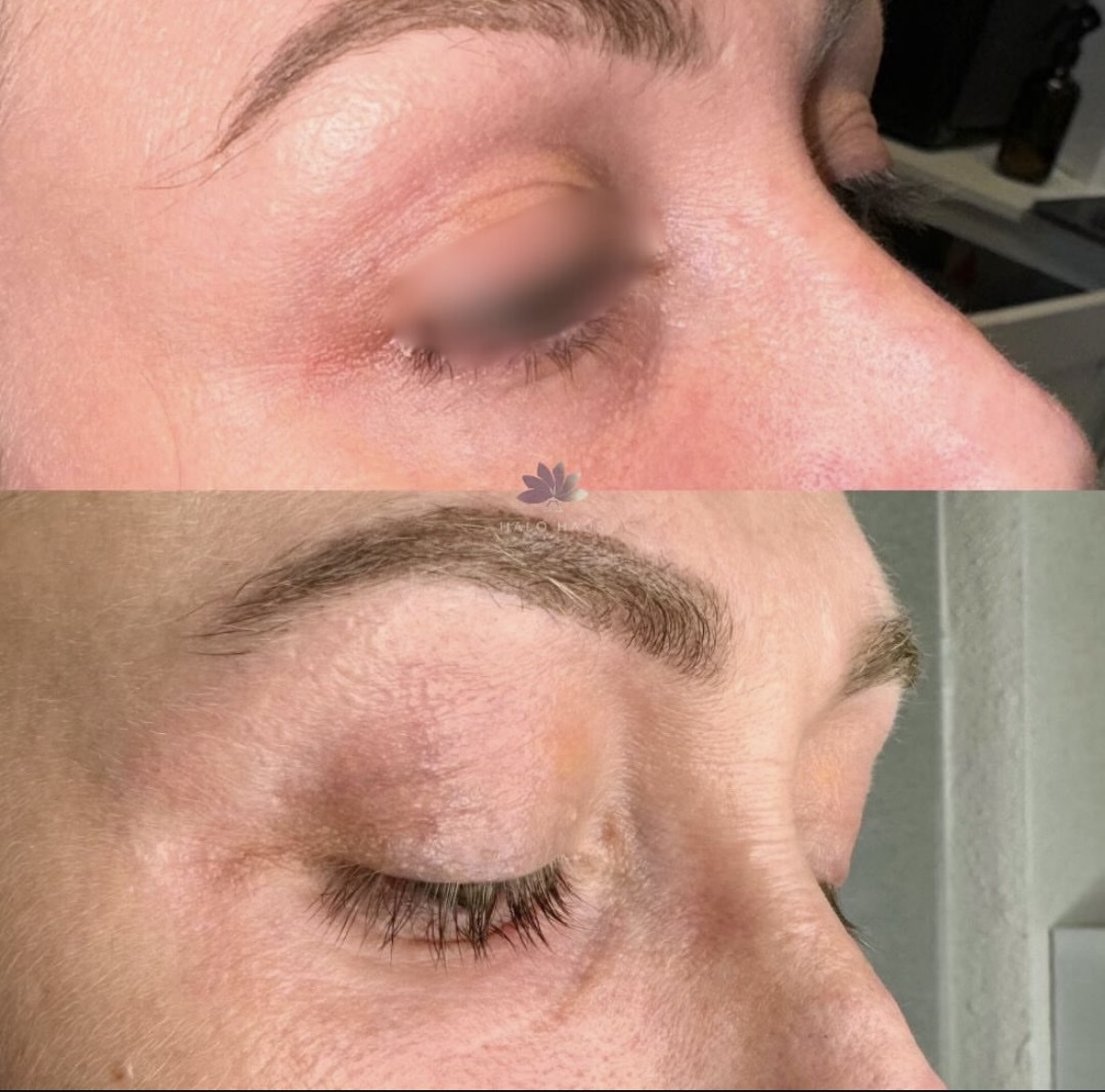 I work off commission at ZenVida Wellness & Aesthetics - Samaná - Skin Cleansing