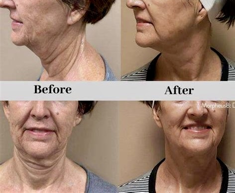 I work off commission at ZenVida Wellness & Aesthetics - Samaná - Beauty services