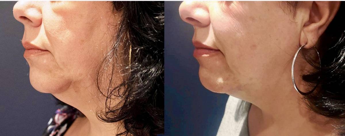 I work off commission at ZenVida Wellness & Aesthetics - Samaná - Beauty services