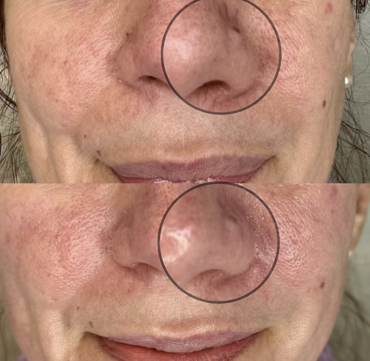 I work off commission at ZenVida Wellness & Aesthetics - Samaná - Skin Cleansing