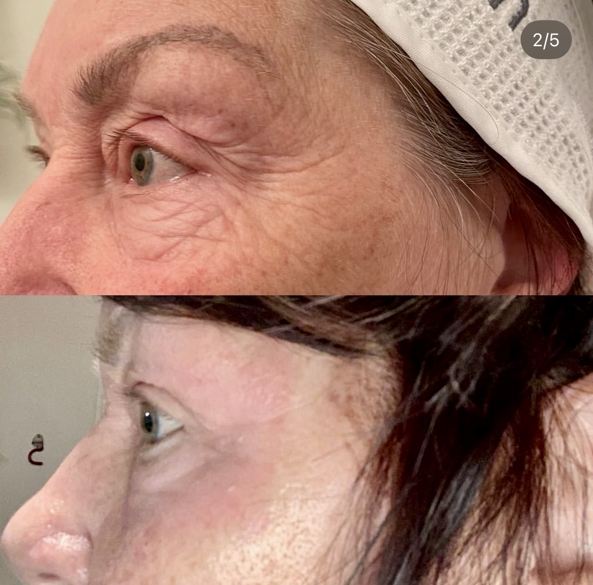 I work off commission at ZenVida Wellness & Aesthetics - Samaná - Beauty services
