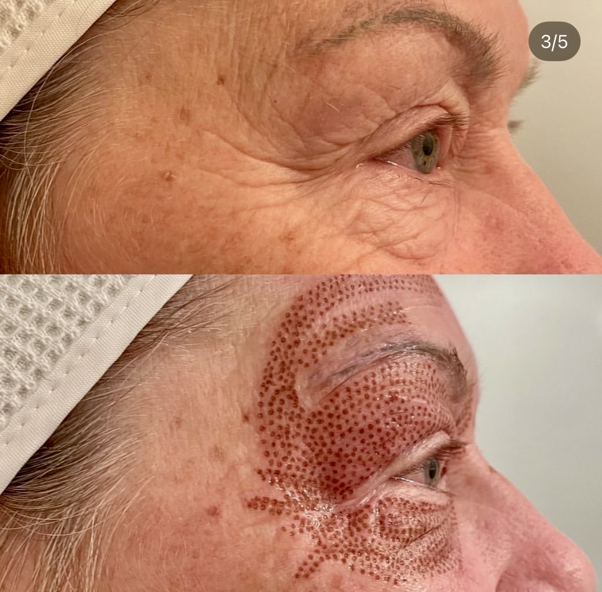 I work off commission at ZenVida Wellness & Aesthetics - Samaná - Skin Cleansing