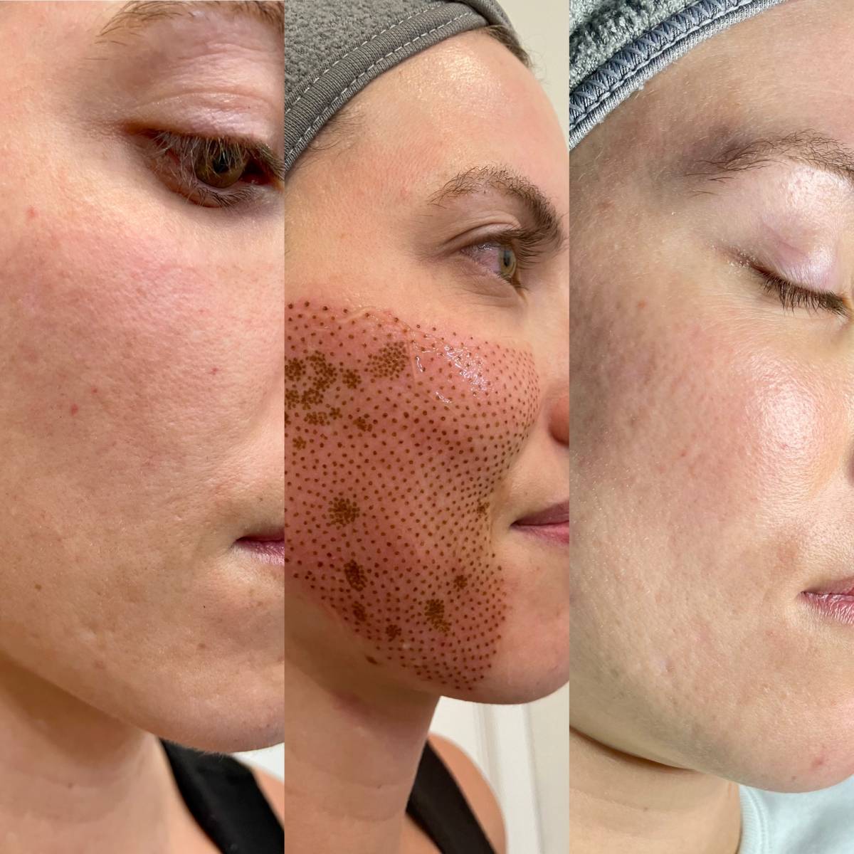 I work off commission at ZenVida Wellness & Aesthetics - Samaná - Beauty services