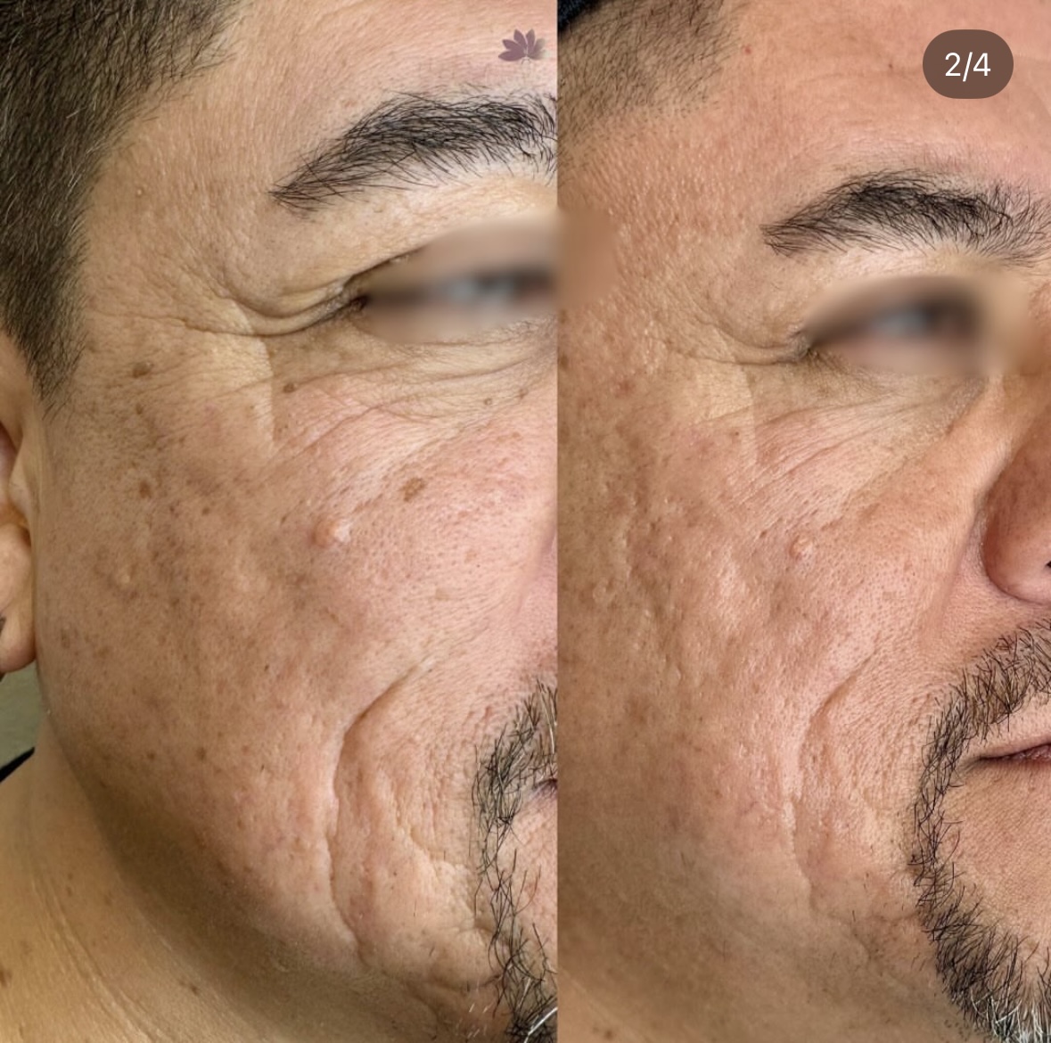 I work off commission at ZenVida Wellness & Aesthetics - Samaná - Beauty services