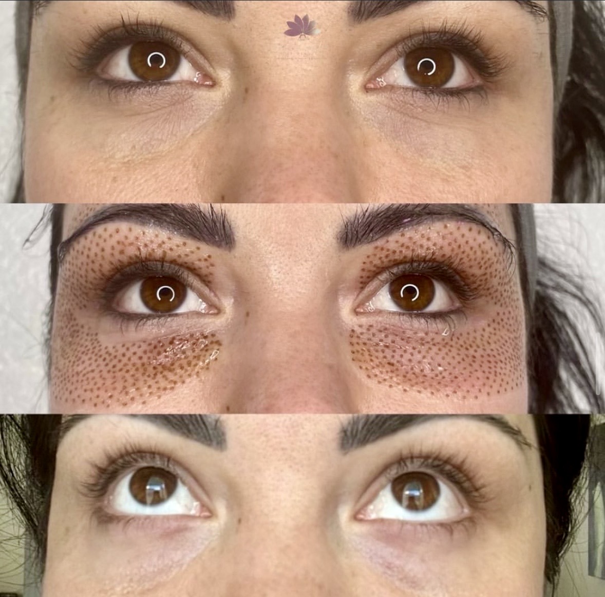 I work off commission at ZenVida Wellness & Aesthetics - Samaná - Skin Cleansing
