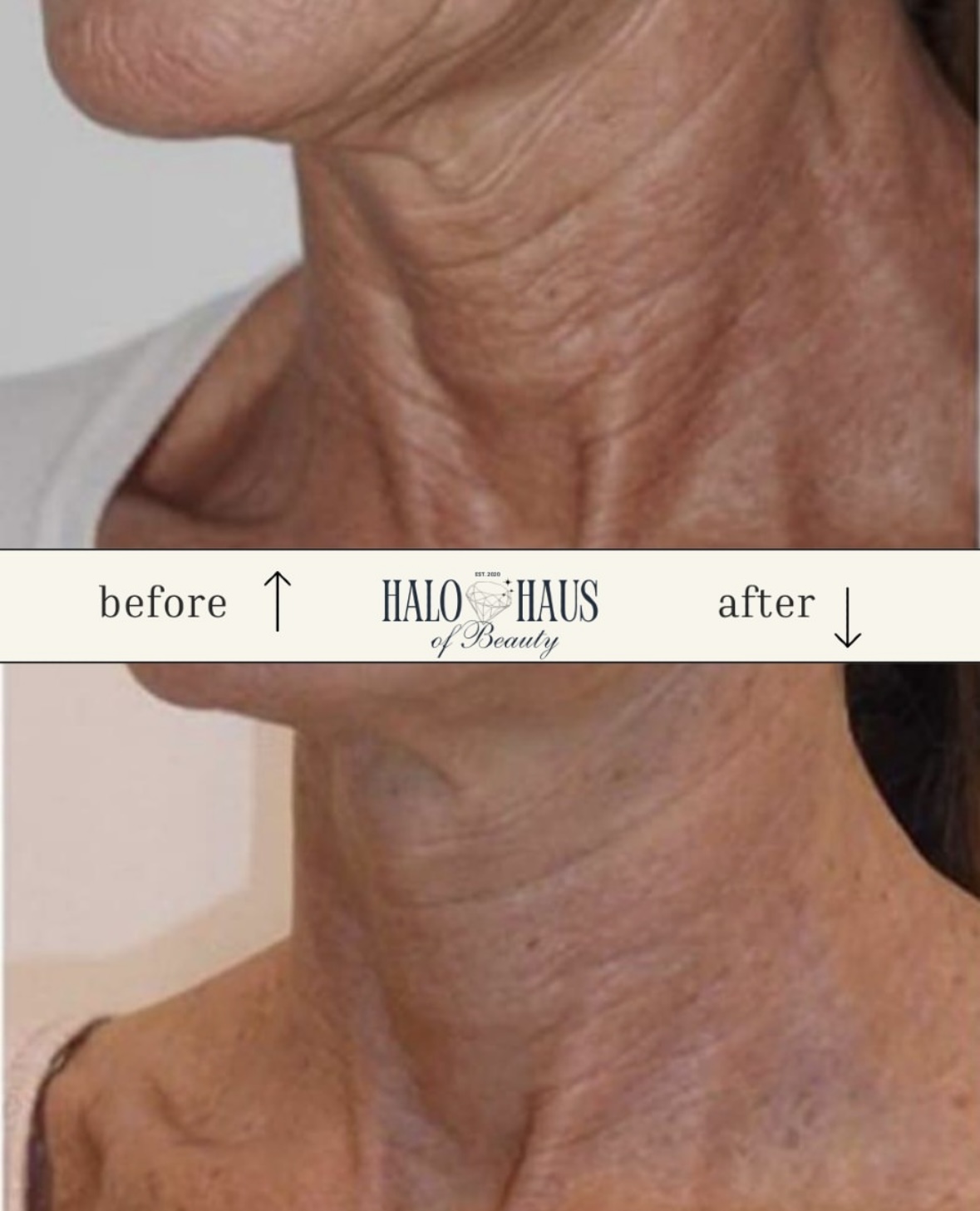I work off commission at ZenVida Wellness & Aesthetics - Samaná - Skin Cleansing