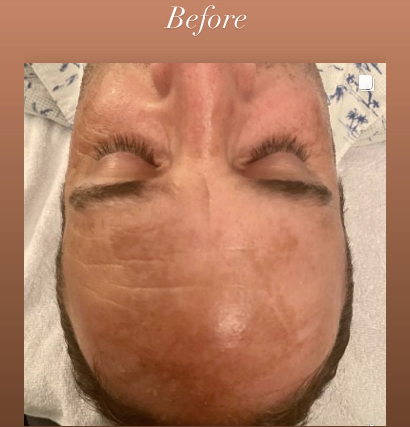 I work off commission at ZenVida Wellness & Aesthetics - Samaná - Skin Cleansing