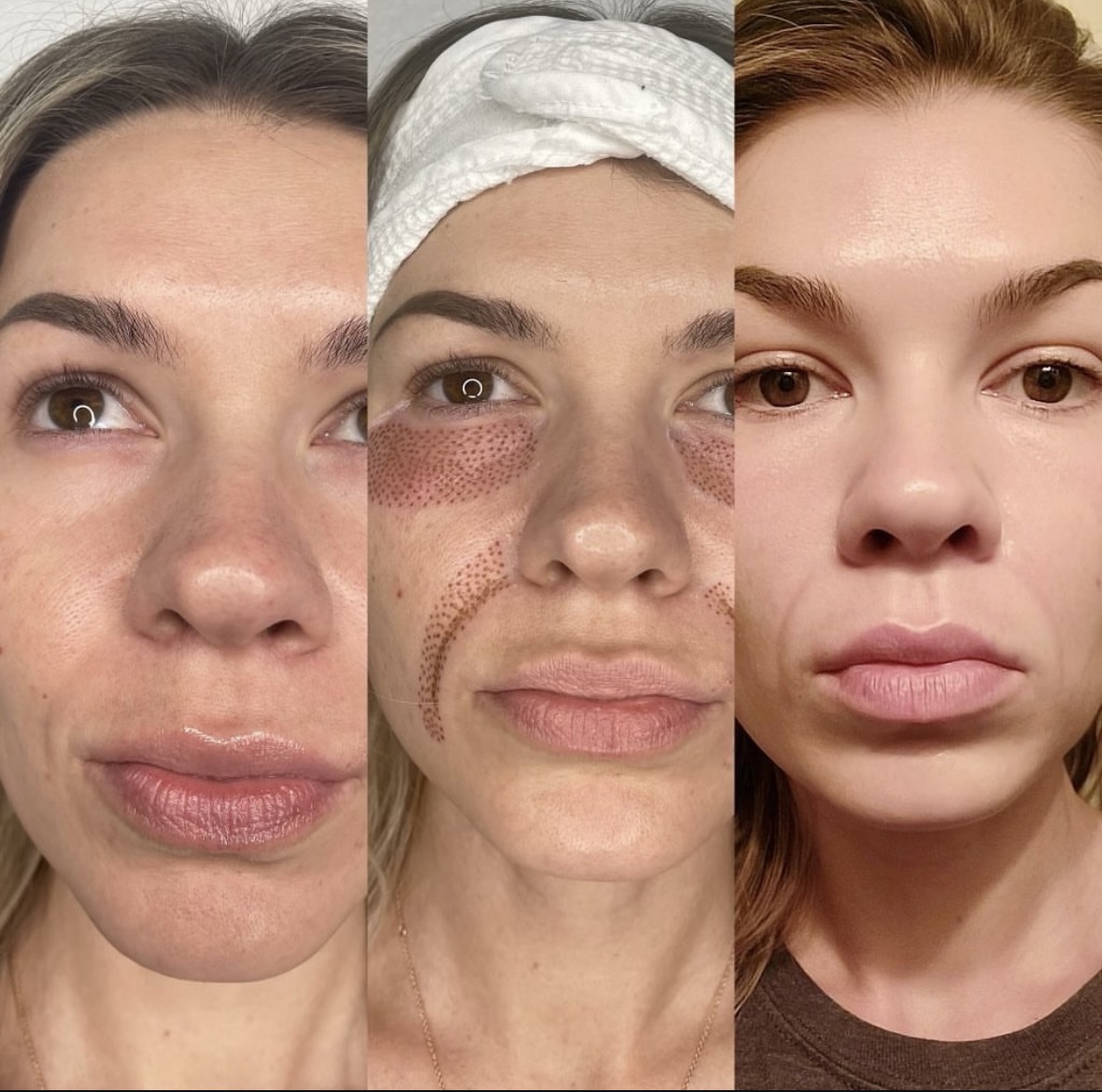 I work off commission at ZenVida Wellness & Aesthetics - Samaná - Skin Cleansing