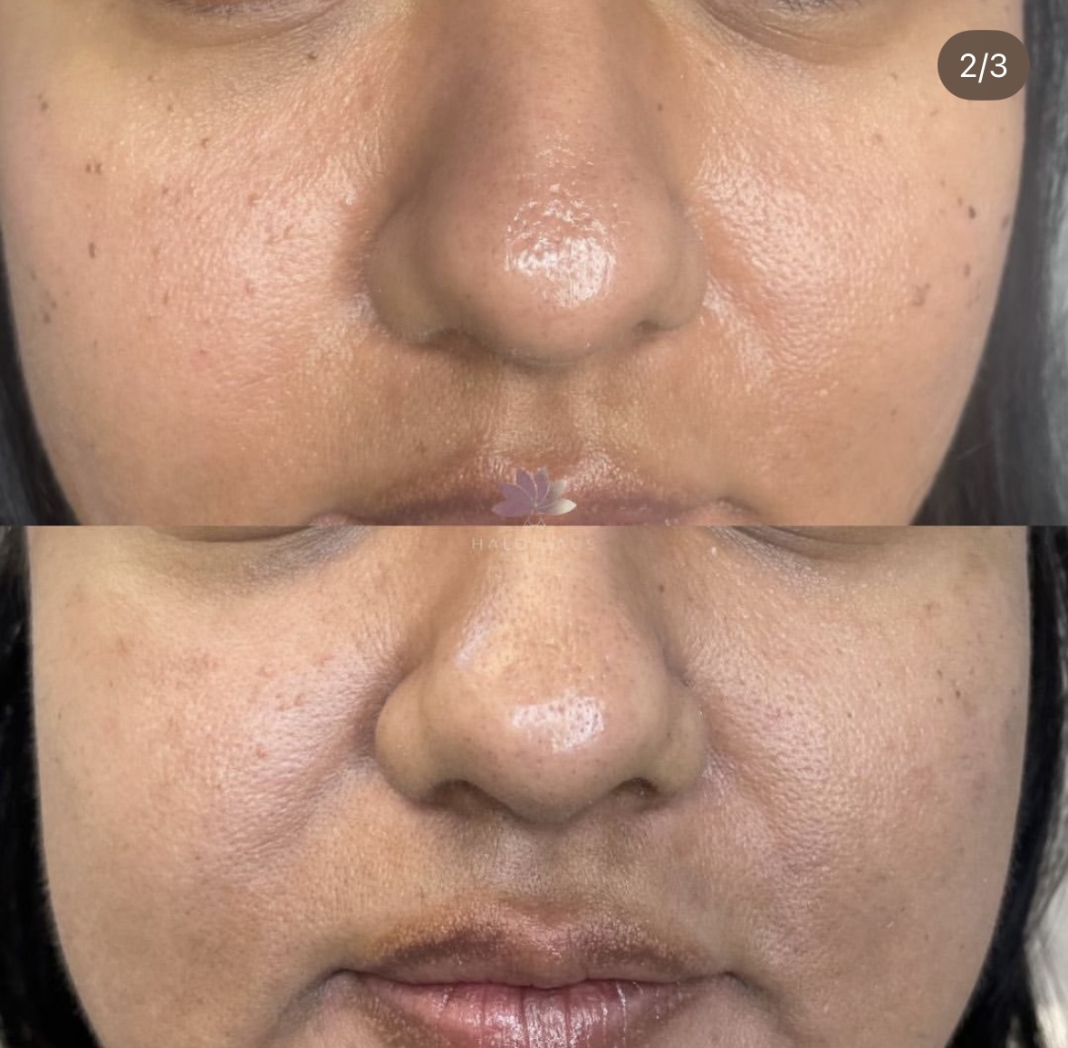 I work off commission at ZenVida Wellness & Aesthetics - Samaná - Beauty services