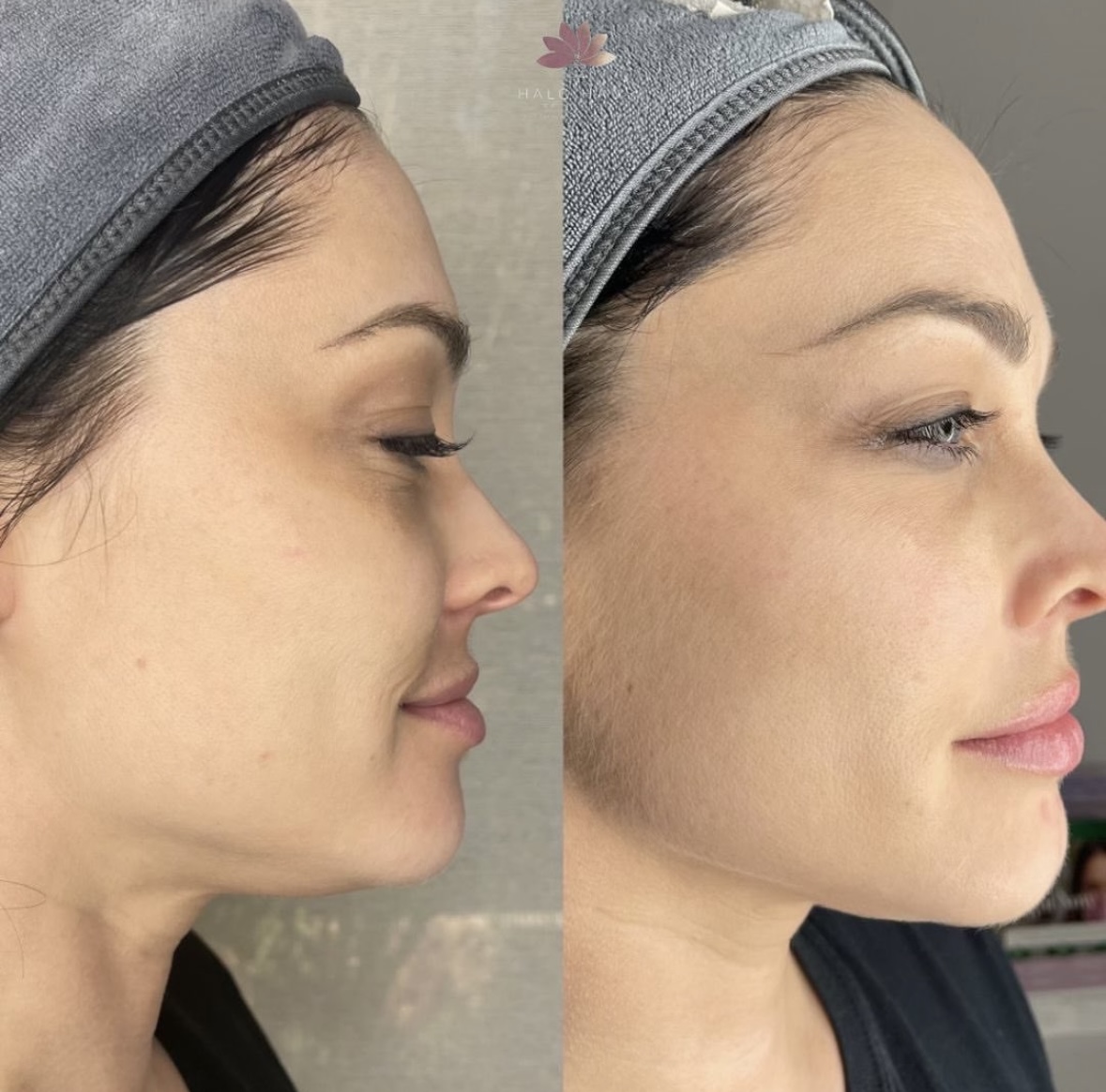 I work off commission at ZenVida Wellness & Aesthetics - Samaná - Skin Cleansing