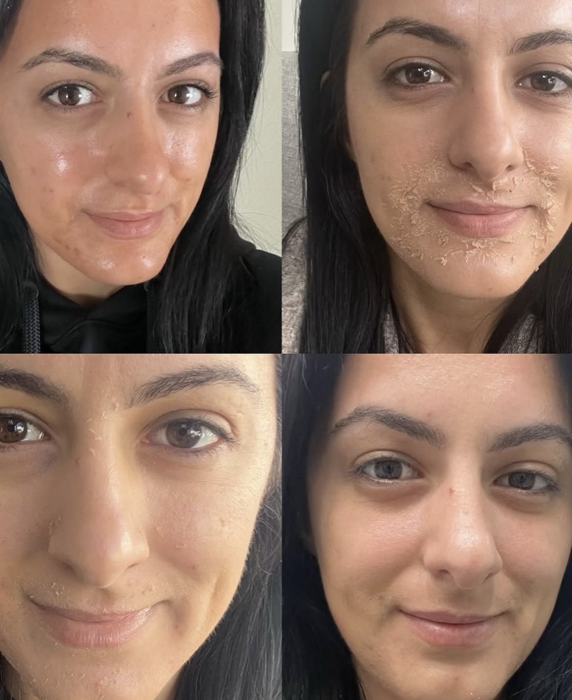 I work off commission at ZenVida Wellness & Aesthetics - Samaná - Skin Cleansing