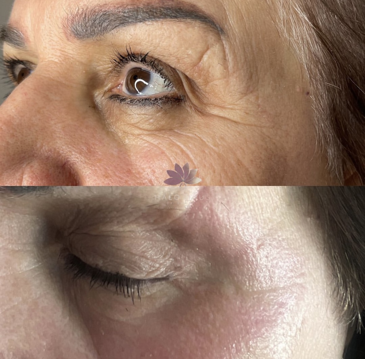 I work off commission at ZenVida Wellness & Aesthetics - Samaná - Beauty services