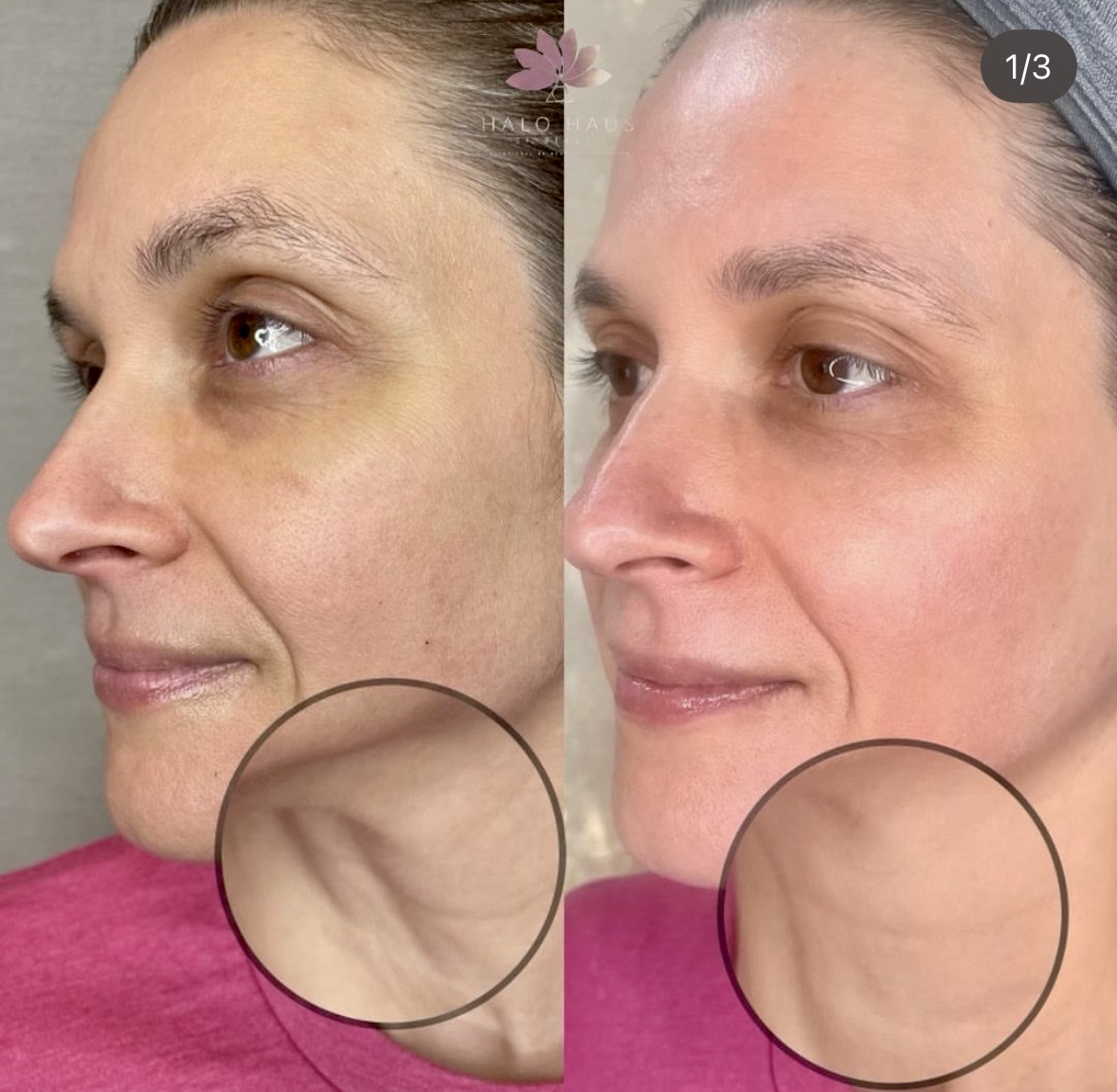 I work off commission at ZenVida Wellness & Aesthetics - Samaná - Beauty services