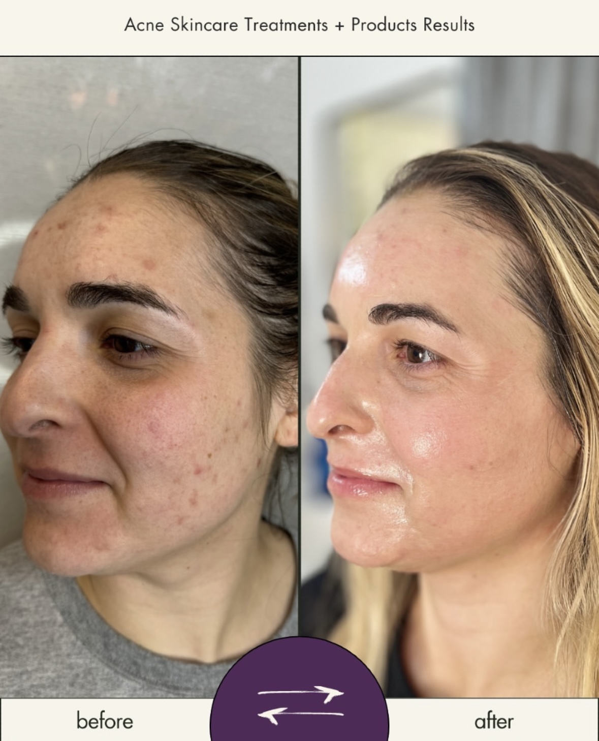 I work off commission at ZenVida Wellness & Aesthetics - Samaná - Skin Cleansing