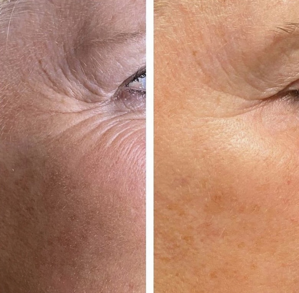 I work off commission at ZenVida Wellness & Aesthetics - Samaná - Beauty services