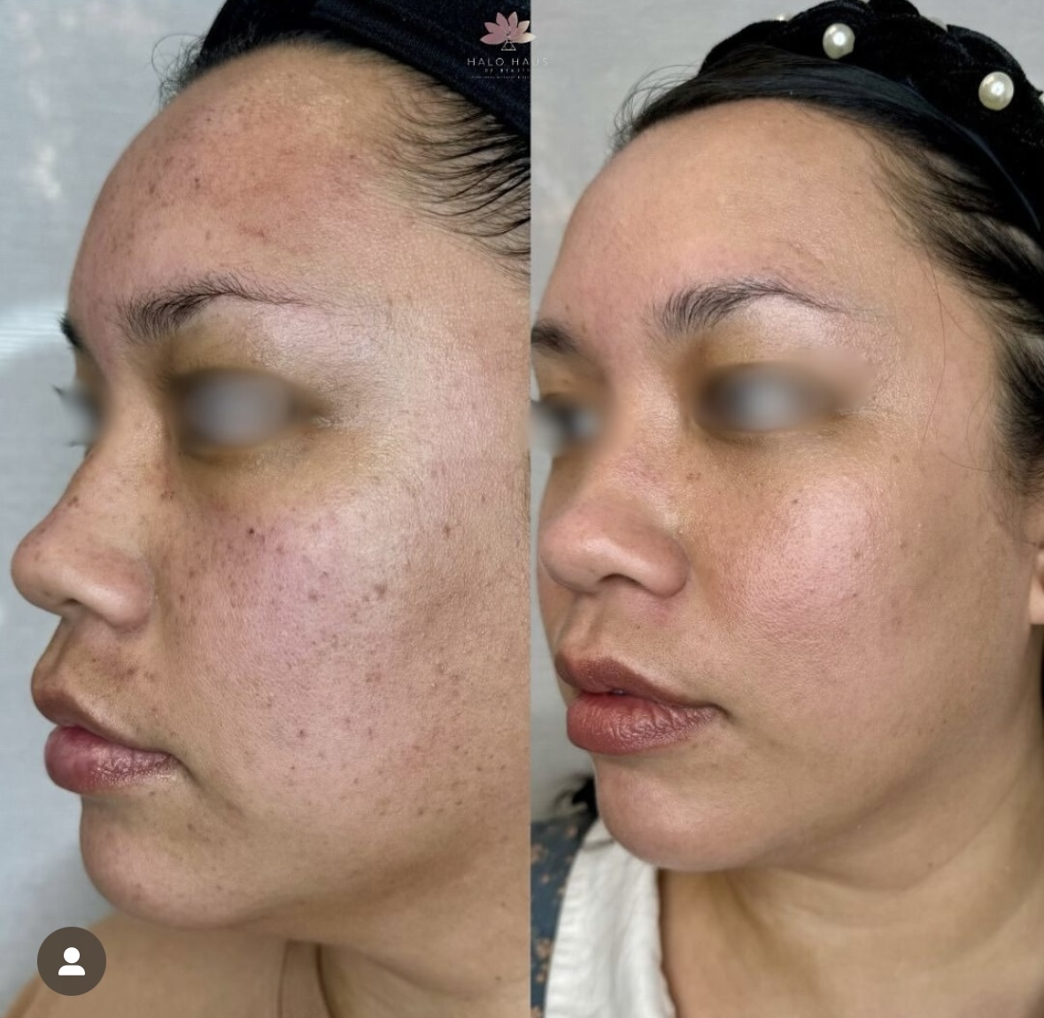 I work off commission at ZenVida Wellness & Aesthetics - Samaná - Beauty services