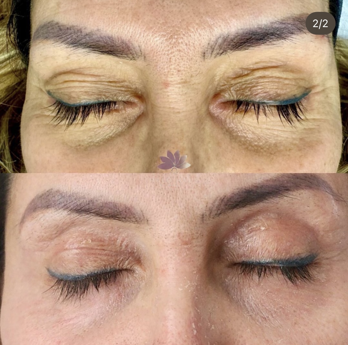 I work off commission at ZenVida Wellness & Aesthetics - Samaná - Skin Cleansing