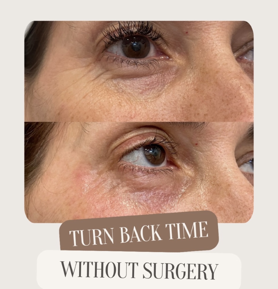 I work off commission at ZenVida Wellness & Aesthetics - Samaná - Skin Cleansing