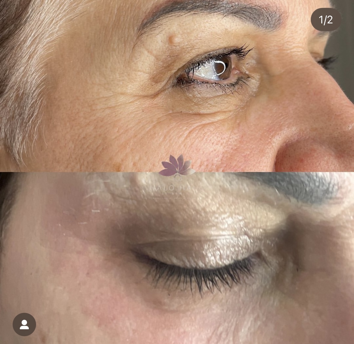 I work off commission at ZenVida Wellness & Aesthetics - Samaná - Skin Cleansing