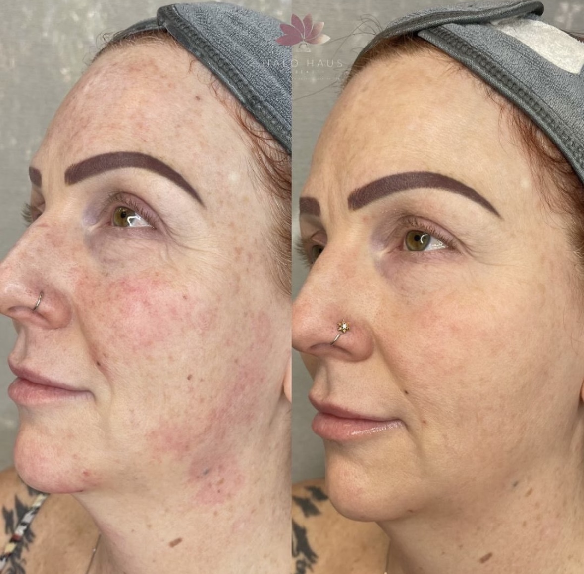 I work off commission at ZenVida Wellness & Aesthetics - Samaná - Beauty services