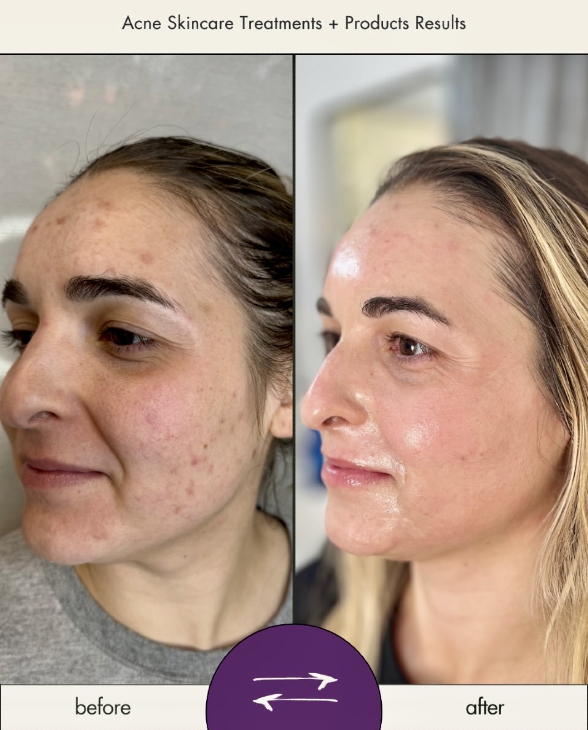 I work off commission at ZenVida Wellness & Aesthetics - Samaná - Skin Cleansing