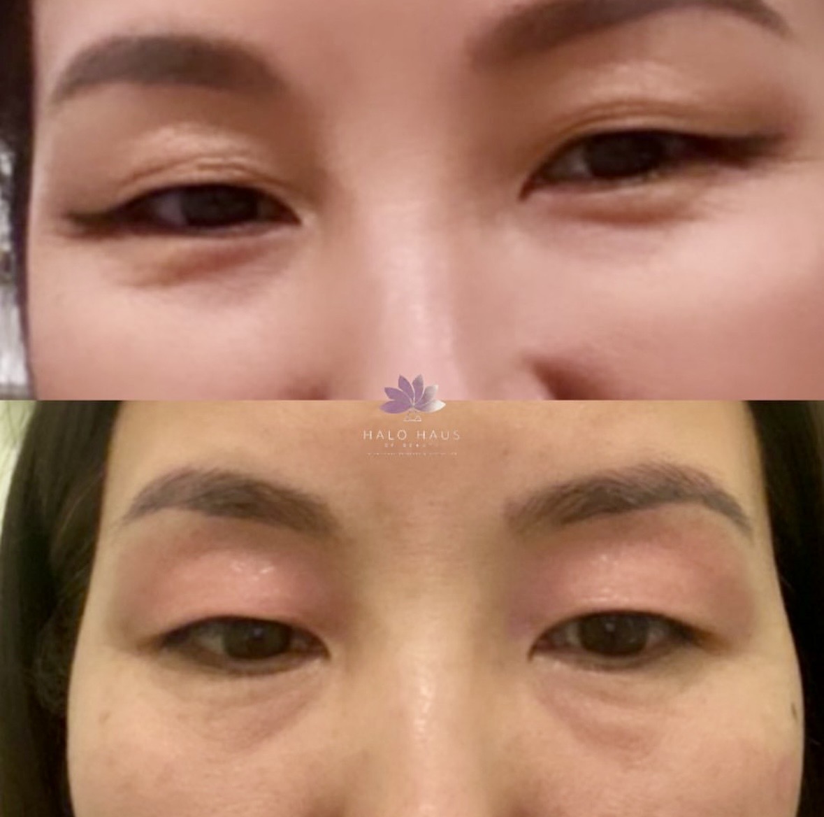 I work off commission at ZenVida Wellness & Aesthetics - Samaná - Skin Cleansing