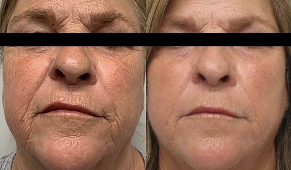 I work off commission at ZenVida Wellness & Aesthetics - Samaná - Beauty services