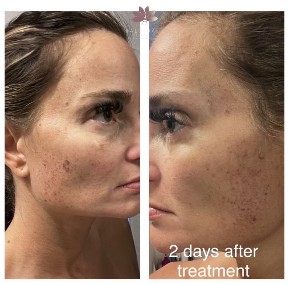 I work off commission at ZenVida Wellness & Aesthetics - Samaná - Beauty services