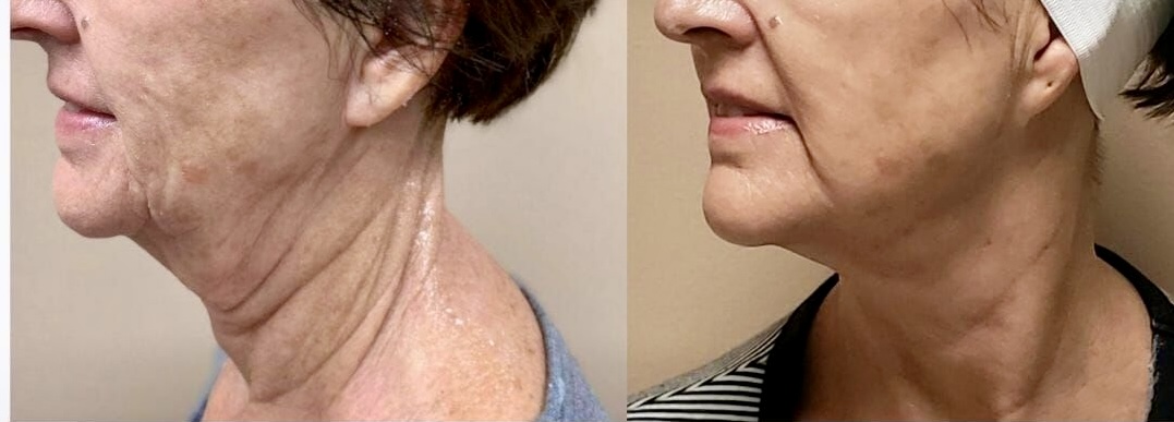 I work off commission at ZenVida Wellness & Aesthetics - Samaná - Beauty services