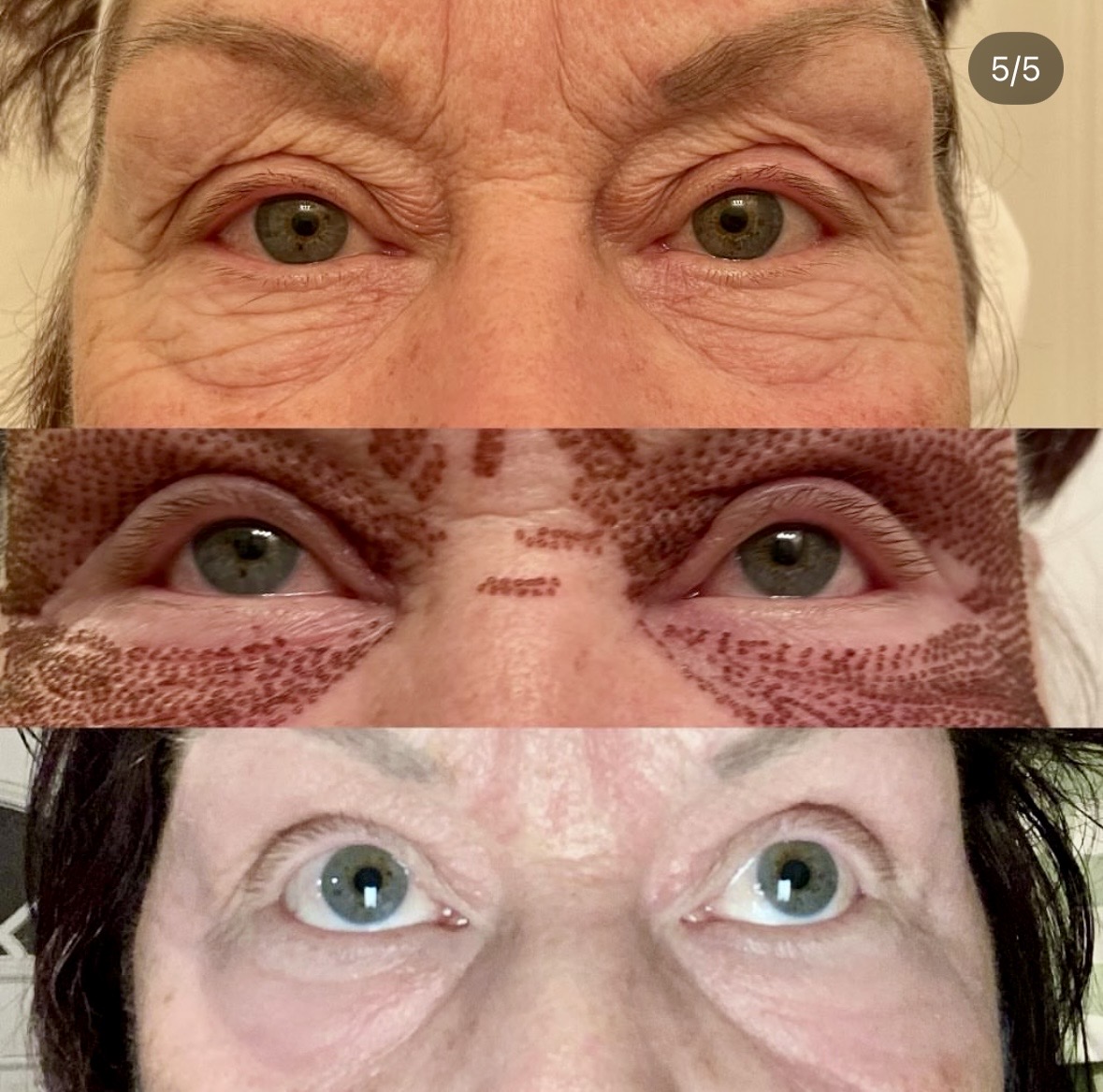 I work off commission at ZenVida Wellness & Aesthetics - Samaná - Skin Cleansing