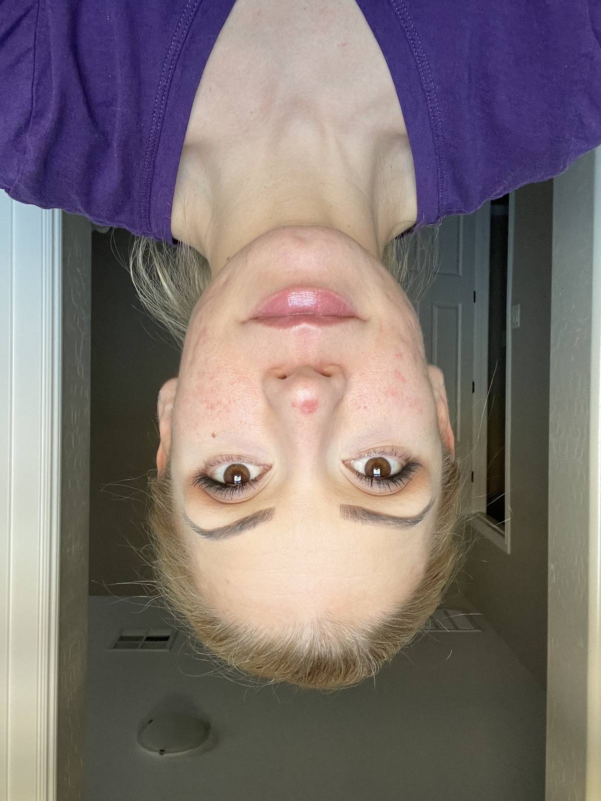 I work off commission at ZenVida Wellness & Aesthetics - Samaná - Skin Cleansing
