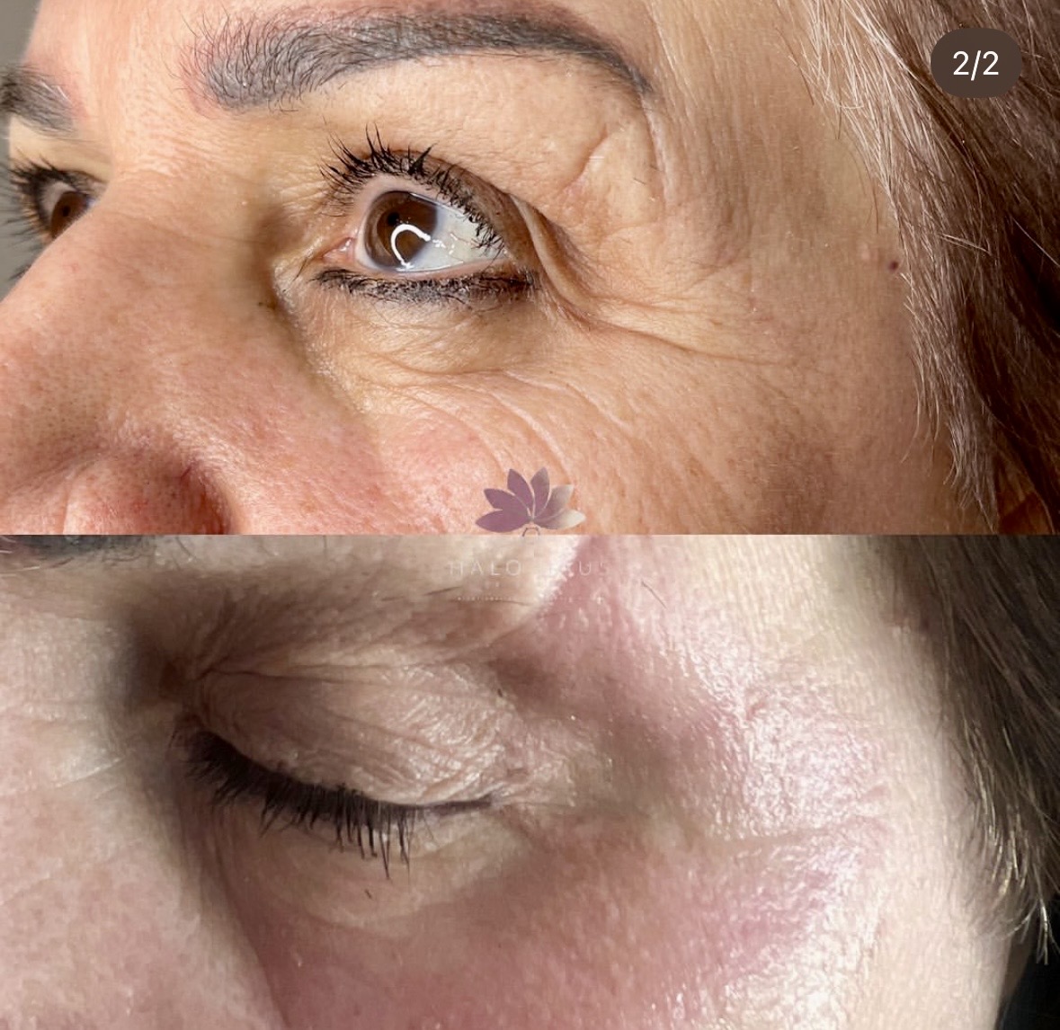 I work off commission at ZenVida Wellness & Aesthetics - Samaná - Skin Cleansing