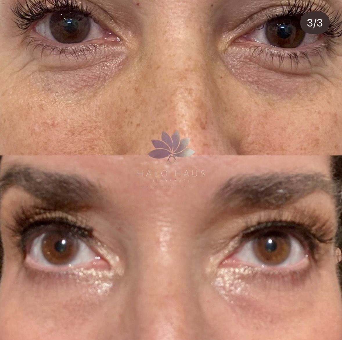 I work off commission at ZenVida Wellness & Aesthetics - Samaná - Skin Cleansing