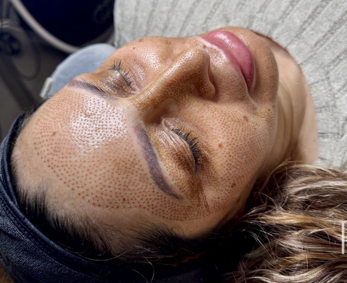 I work off commission at ZenVida Wellness & Aesthetics - Samaná - Skin Cleansing