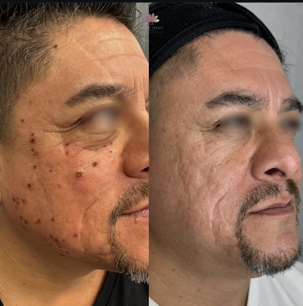 I work off commission at ZenVida Wellness & Aesthetics - Samaná - Beauty services