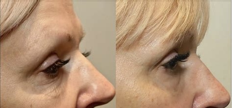 I work off commission at ZenVida Wellness & Aesthetics - Samaná - Beauty services
