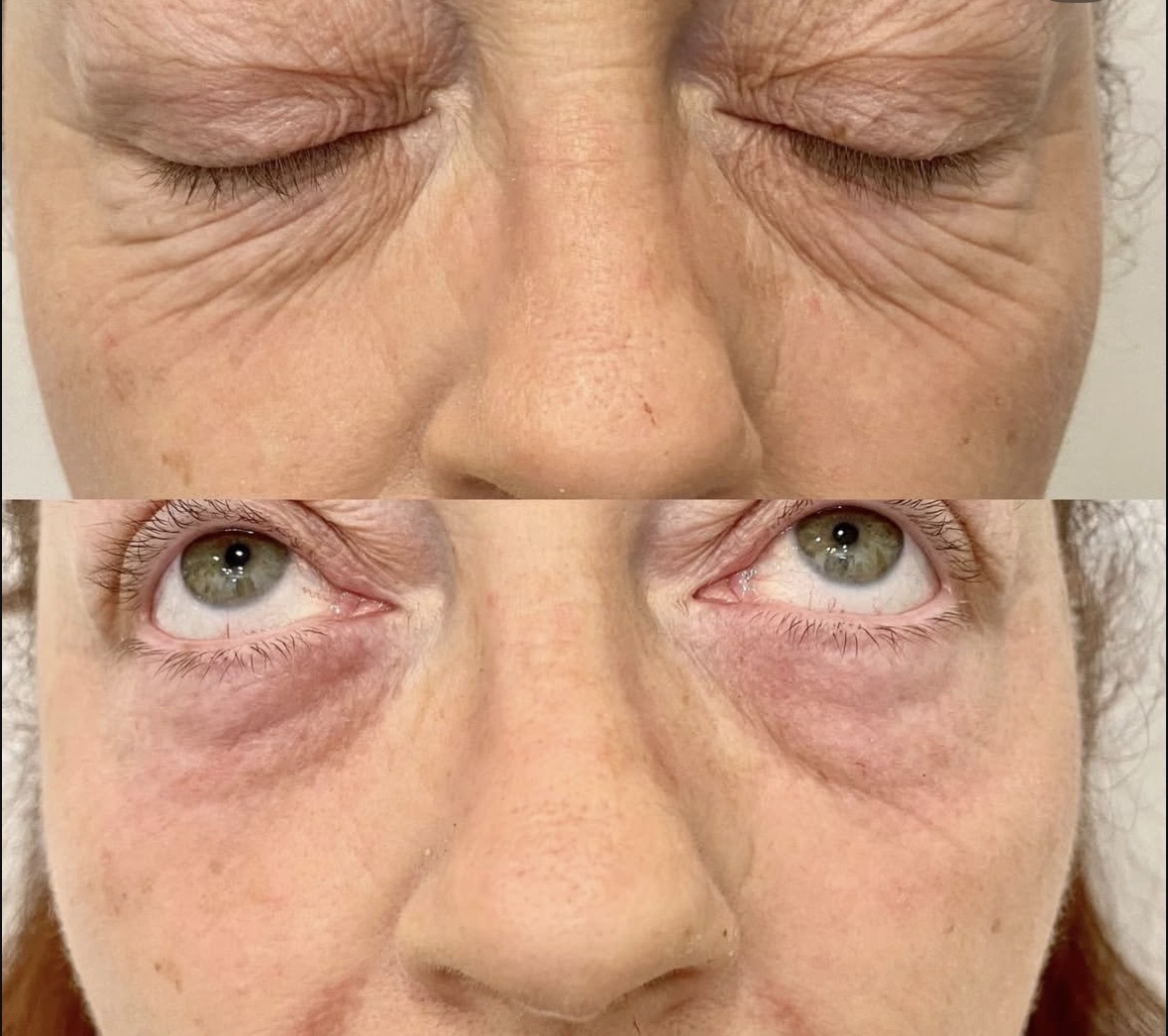 I work off commission at ZenVida Wellness & Aesthetics - Samaná - Skin Cleansing