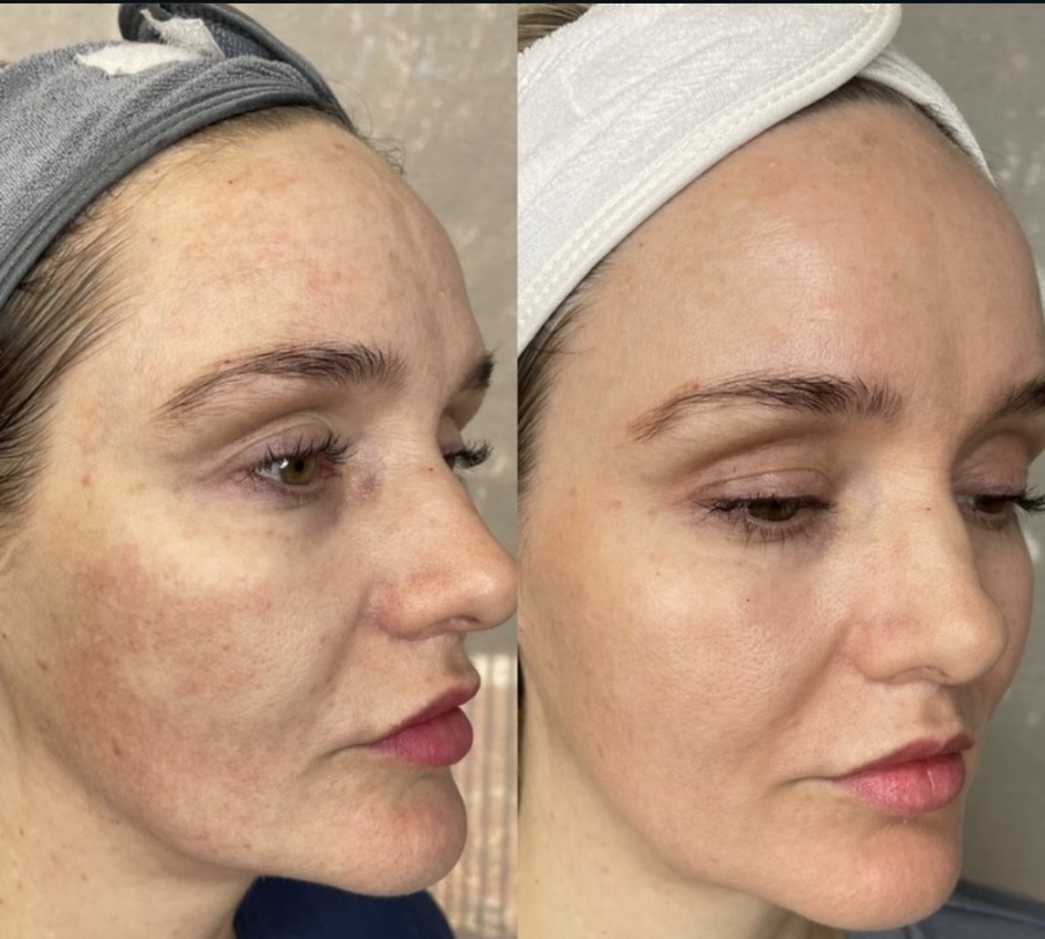 I work off commission at ZenVida Wellness & Aesthetics - Samaná - Beauty services