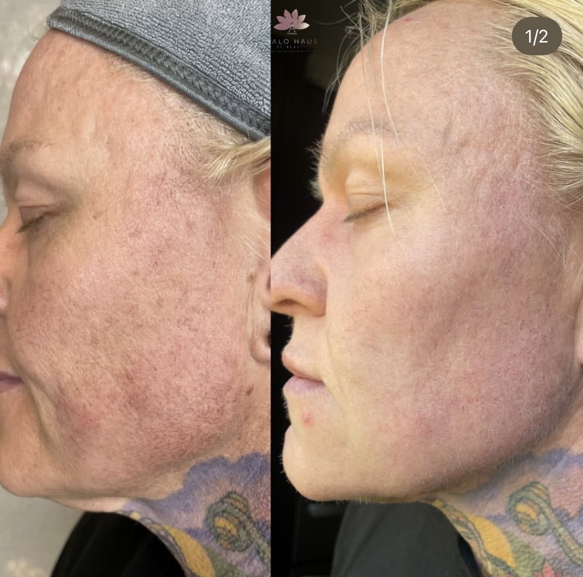 I work off commission at ZenVida Wellness & Aesthetics - Samaná - Beauty services