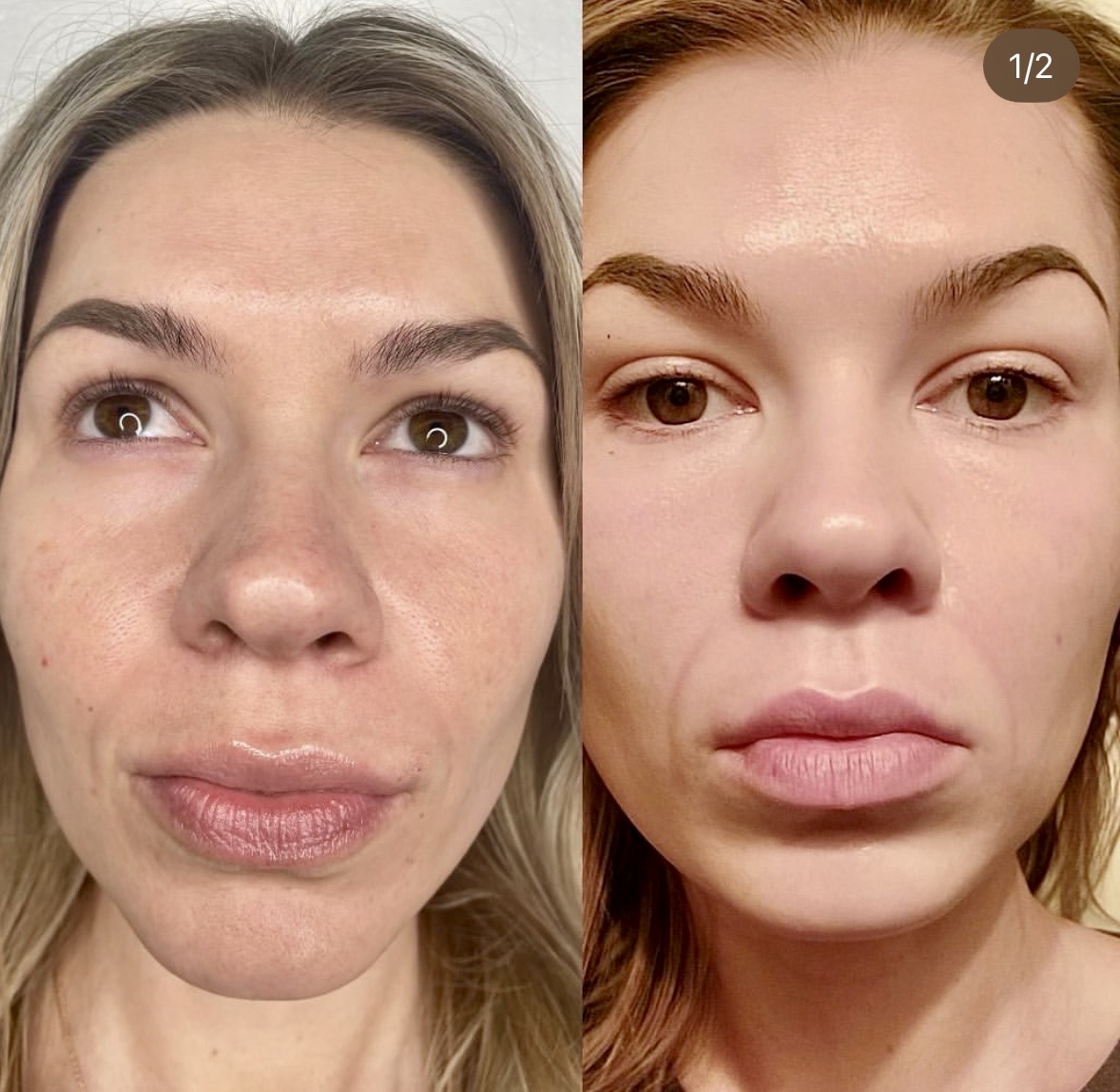 I work off commission at ZenVida Wellness & Aesthetics - Samaná - Beauty services