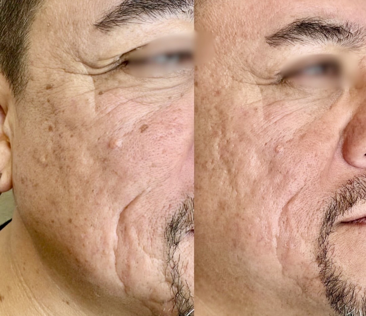 I work off commission at ZenVida Wellness & Aesthetics - Samaná - Skin Cleansing