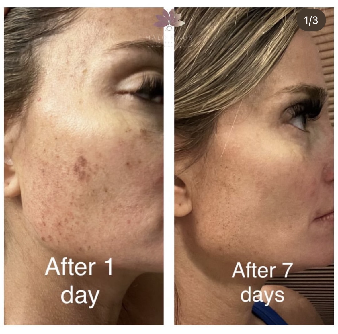 I work off commission at ZenVida Wellness & Aesthetics - Samaná - Beauty services