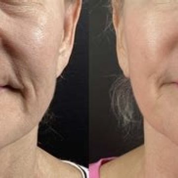 I work off commission at ZenVida Wellness & Aesthetics - Samaná - Beauty services